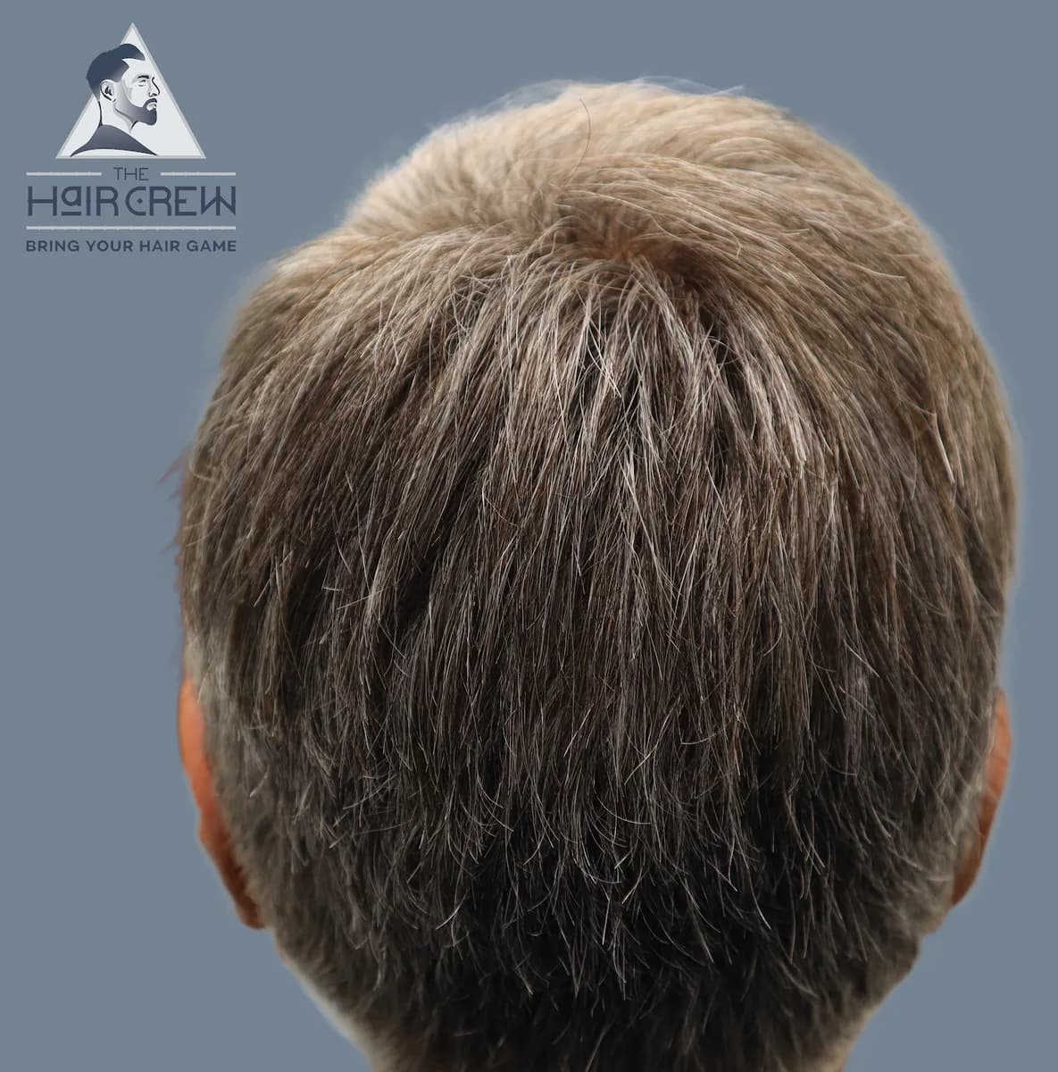 Rear and side view of a client's grey hair system, matched to his natural colour