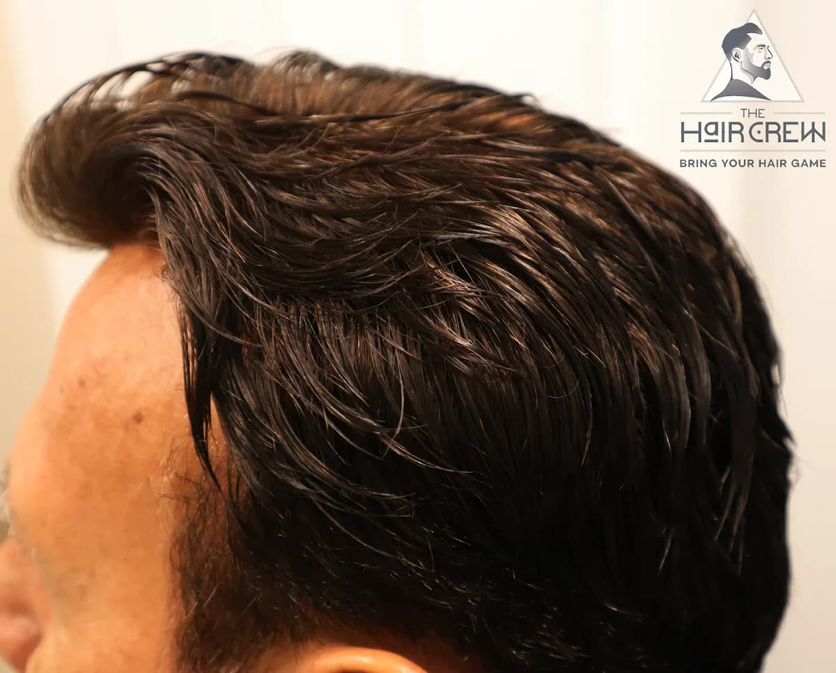 Side and top view of a client finished hair system