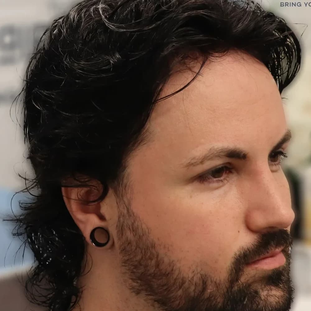 After: Hair Crew client's hair replacement transformation